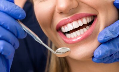 Younger woman visiting the dentist related to Tooth fillings and MS