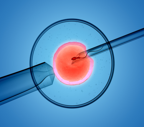 Image of a egg being fertilised in a lab, featured image around fertility treatment and MS