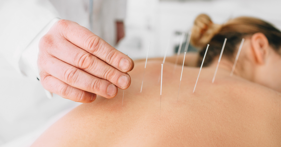 Featured image of acupuncture physiotherapist