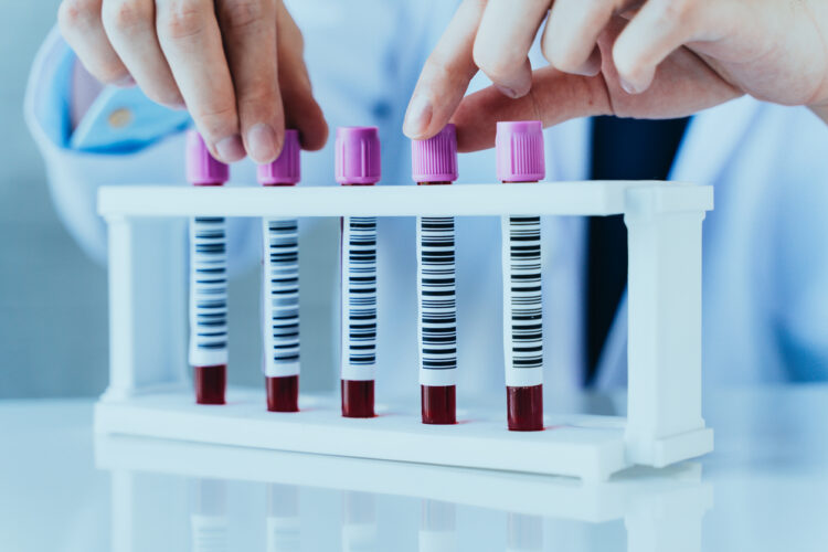 Scientist examining blood samples in a lab - featured image to illustrate primary progressive ms and secondary progressive ms differences