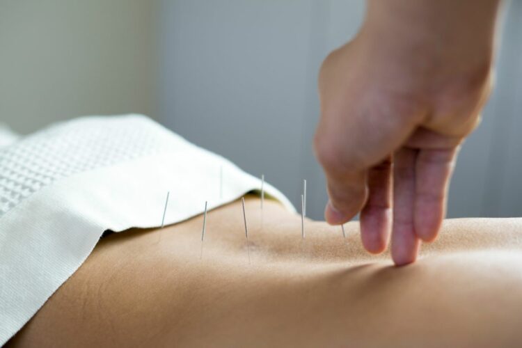 Person receiving acupuncture as a treatment for multiple sclerosis