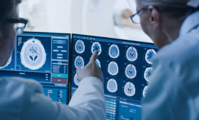 Doctor and radiologist discussing MRI results on a screen, featured image related to the news topic of how damaged myelin may be more harmful than myelin that's lost